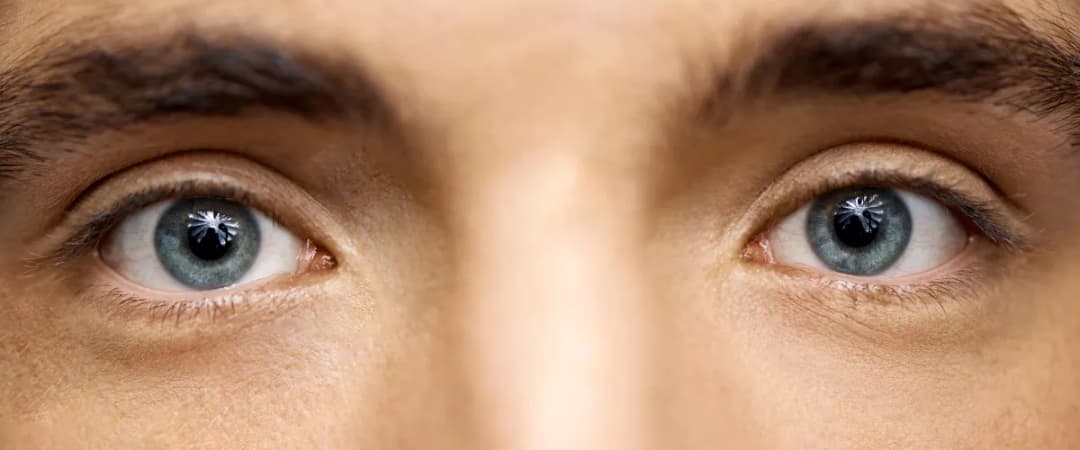 Example image for wide-set-shaped eyes